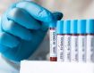 Preventing Pathogen Passage by Taking Precautions Against the Century Pandemic