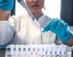 Cellular Housekeeping: How autophagy models in mice could lead to treatment in humans